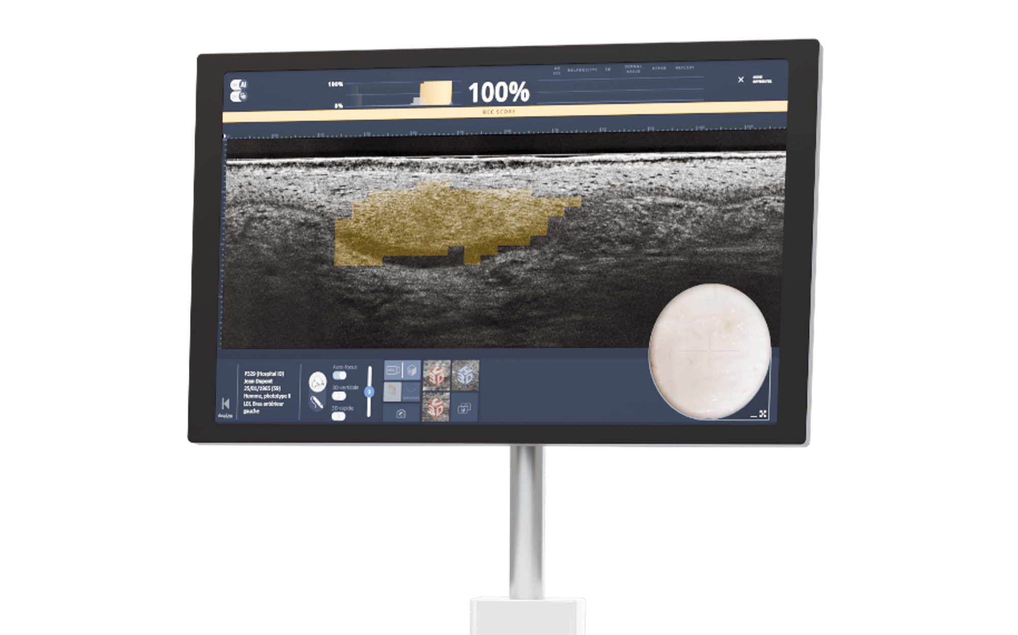 deepLive screen deepLive screen